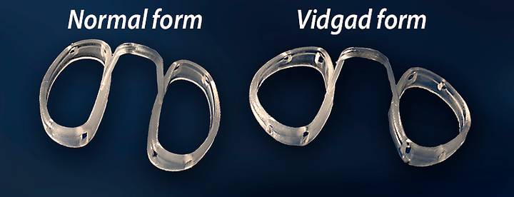 Megavent näsvidgare | Dormitek Medical